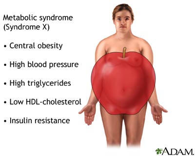 metabolic syndrome
