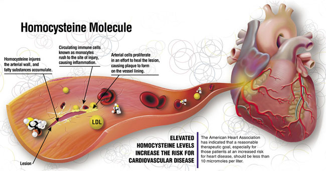 Homocysteine-Damage