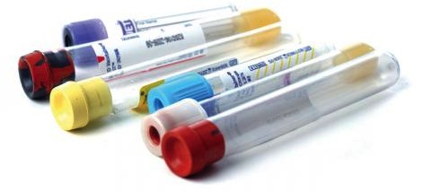 lab vials testing