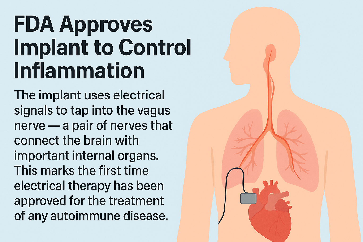 a web-friendly image illustrating the FDA's groundbreaking approval of a vagus nerve implant for autoimmune disease treatment.